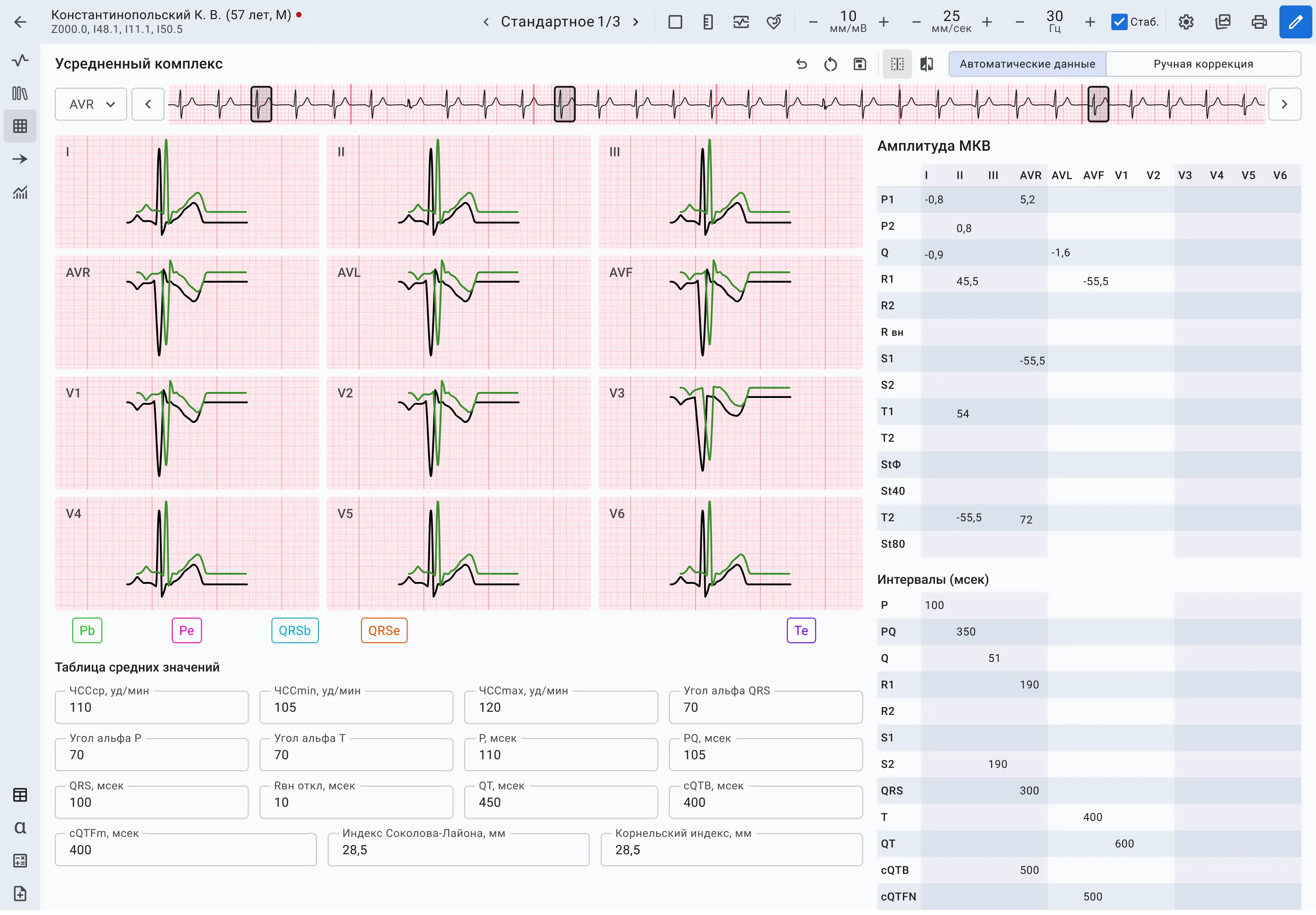 Медицинский интерфейс для работы с ЭКГ | SobakaPav.ru