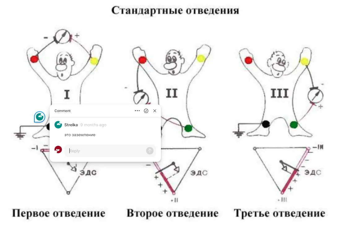 Медицинский интерфейс для работы с ЭКГ | SobakaPav.ru