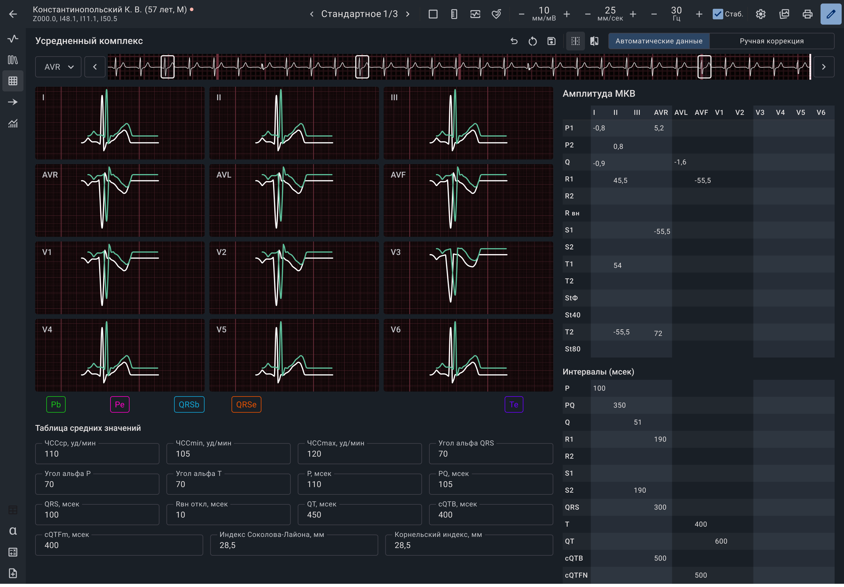 Медицинский интерфейс для работы с ЭКГ | SobakaPav.ru