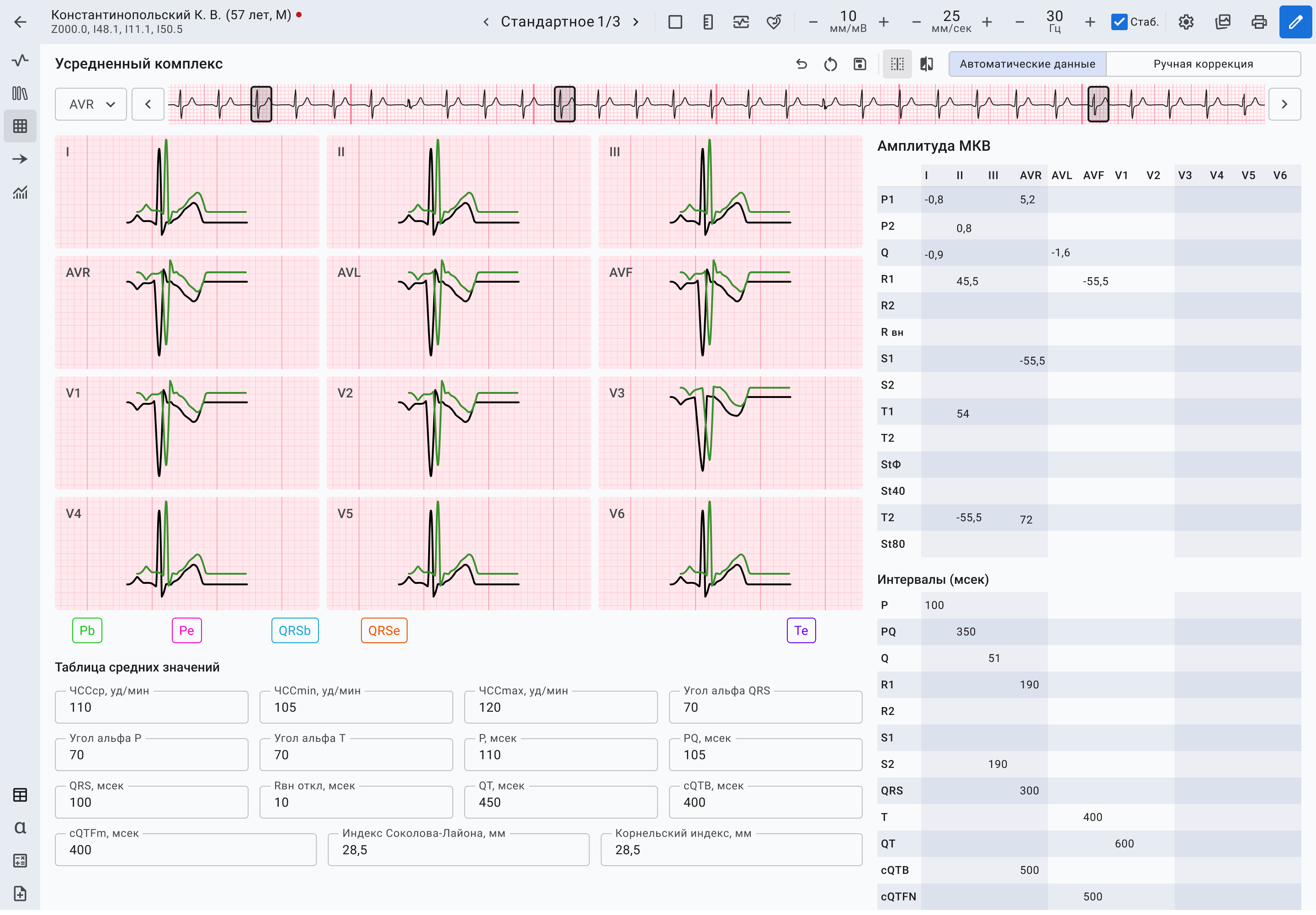 Медицинский интерфейс для работы с ЭКГ | SobakaPav.ru
