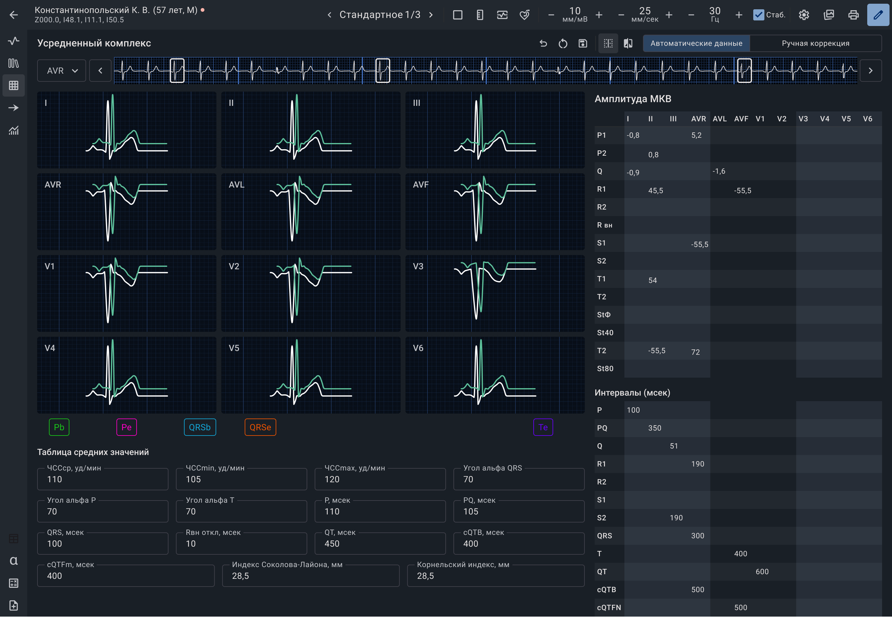 Медицинский интерфейс для работы с ЭКГ | SobakaPav.ru
