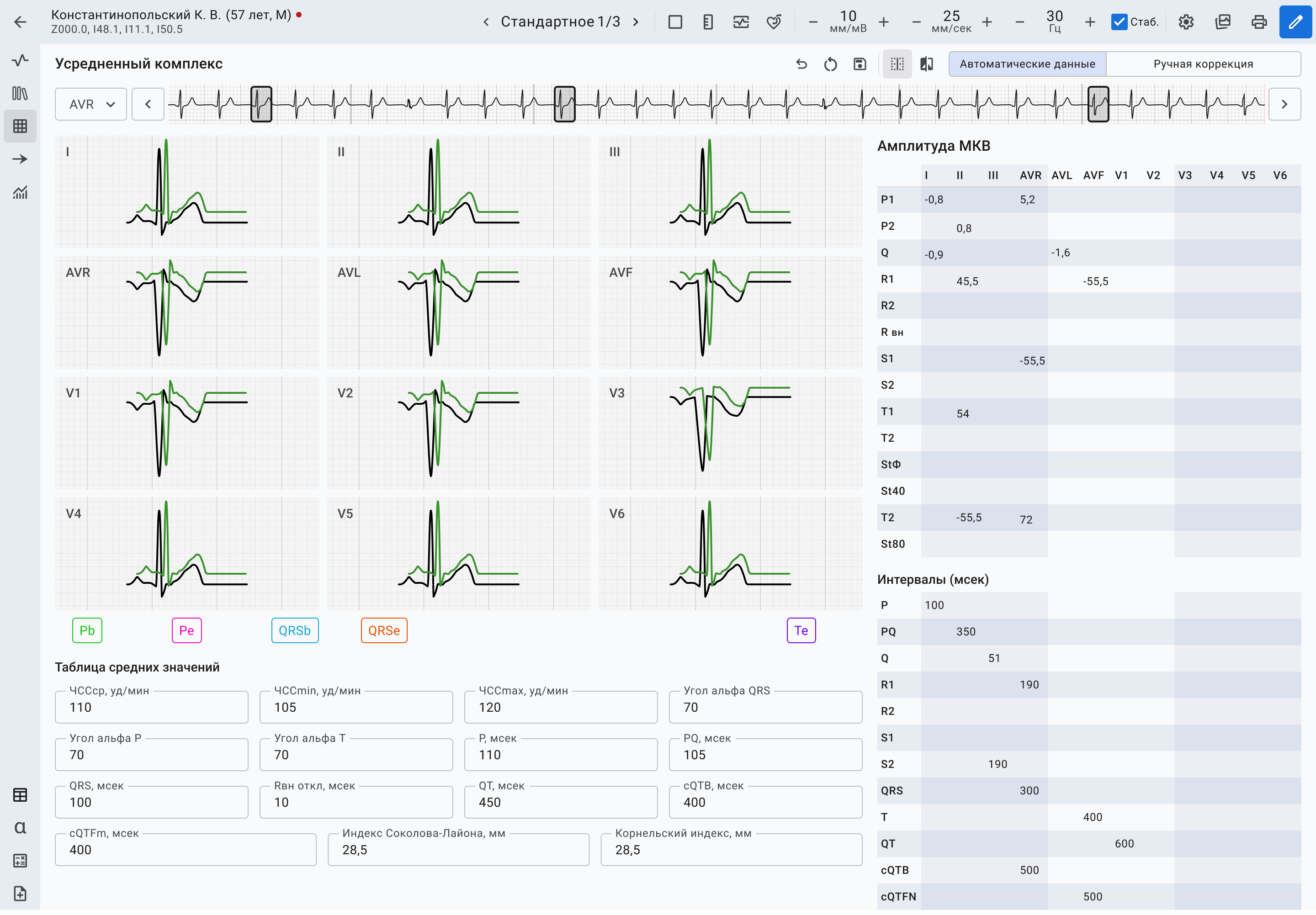 Медицинский интерфейс для работы с ЭКГ | SobakaPav.ru